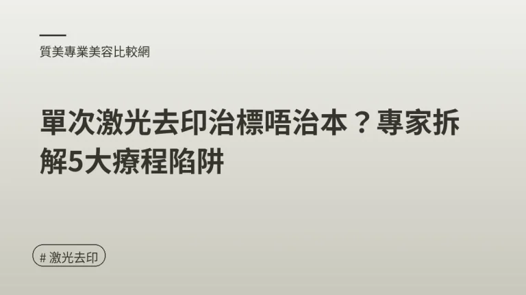 激光去印