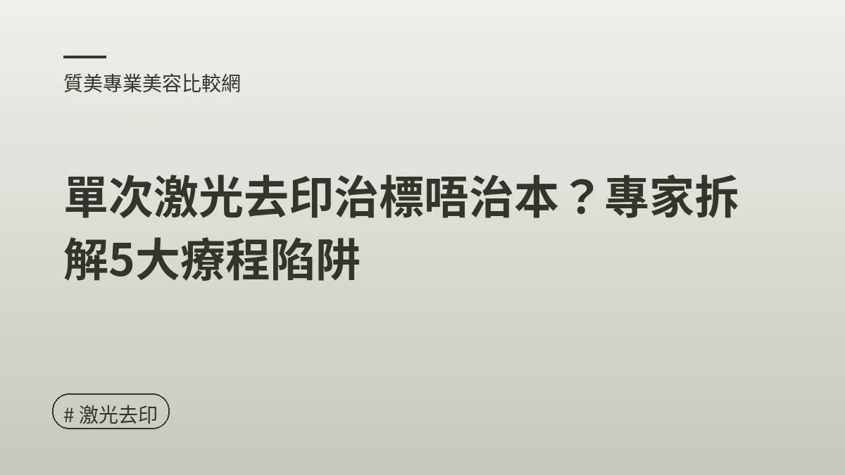 激光去印